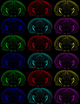 Coronal sections of brain depicting cortical plasticity gene expression during development.