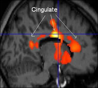 Image of a PET scan showing cingulate.