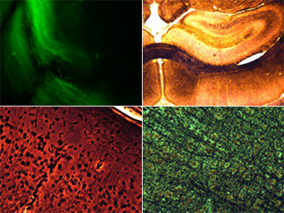 Four photos of histological stains and fluorescent tracers of fiber tracts, structures, and cells in the brain.